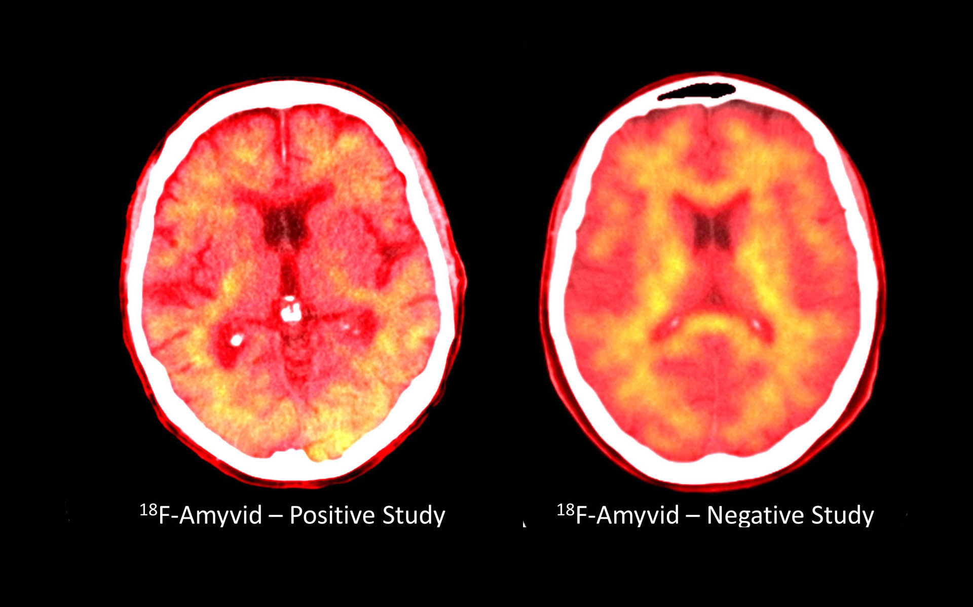 PET Imaging at Center for Imaging Research